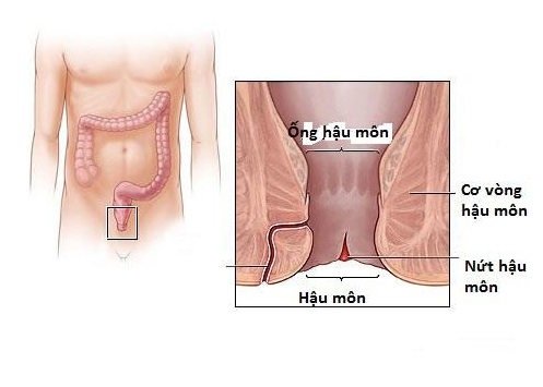 Rách hậu môn gây đau cho sản phụ sau sinh