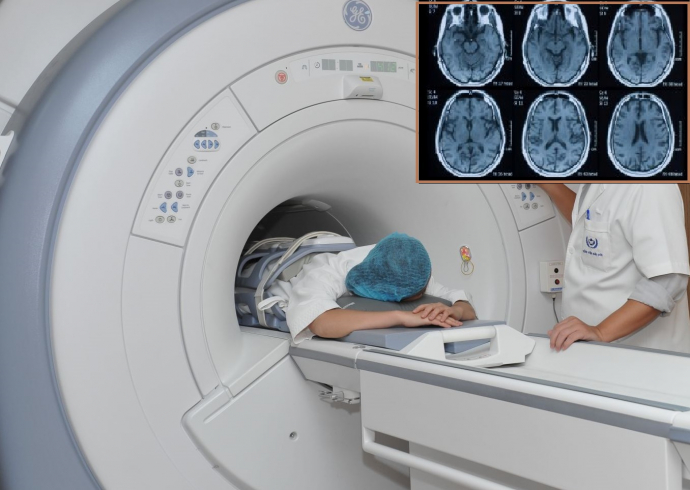 Chụp MRI ít gây hại như CT, XQuang