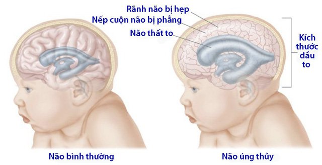 nao-ung-thuy-0