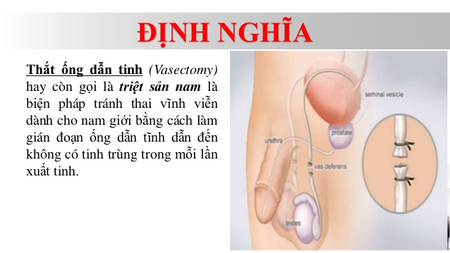 tht-ng-dn-tinh-trit-sn-nam-k-hoch-ha-gia-nh-bin-php-trnh-thai-vnh-vin-2-638-1