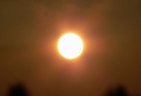 heat-rash-s16-photo-of-sun-in-sky