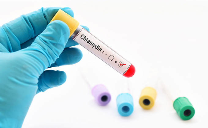 20201213_Chlamydia-test-nhanh-3
