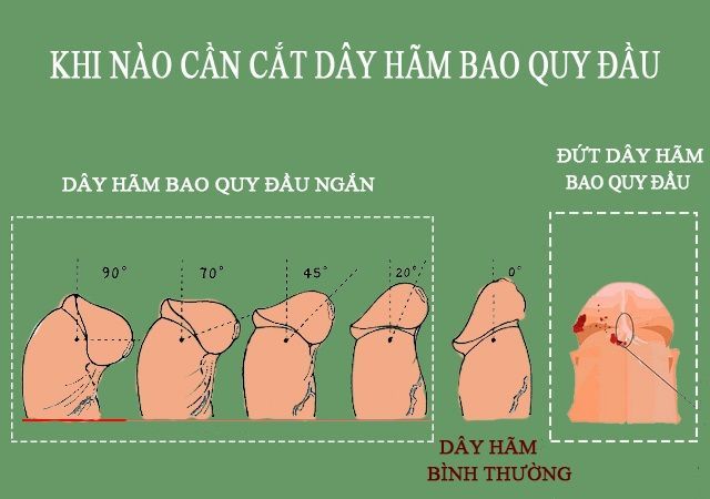 6090cf2be2131ece6a9a2222_khi-nao-can-cat-day-ham-bao-quy-dau (FILEminimizer)