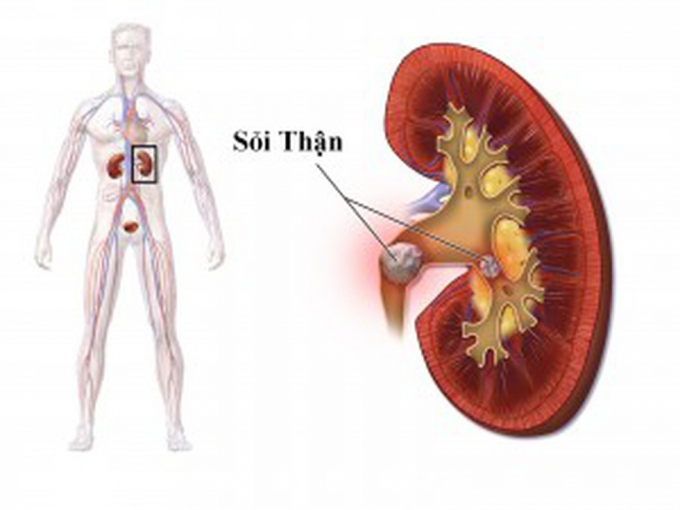 7-cach-phong-ngua-soi-than-hinh-thanh-thuc-hien-moi-ngay-khong-lo-bi-benh