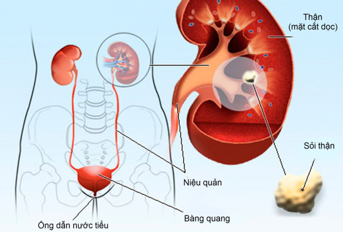 7-cach-phong-ngua-soi-than-hinh-thanh-thuc-hien-moi-ngay-khong-lo-bi-benh1