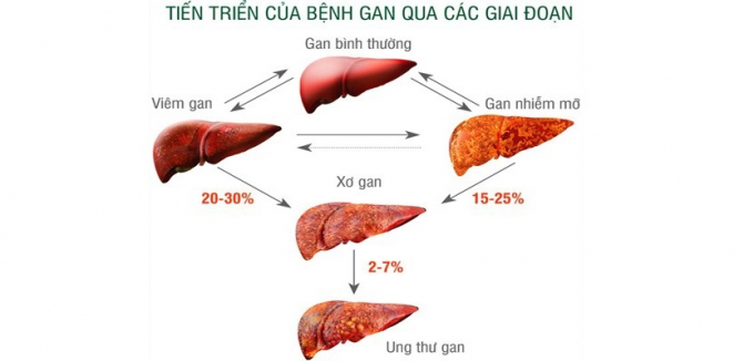 khi-co-su-thay-doi-nay-xay-ra-o-nguc-90-kha-nang-ban-da-bi-xo-gan-hay-nhanh-di-kham