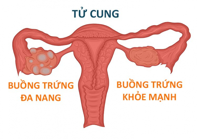 buong-trung-da-nang