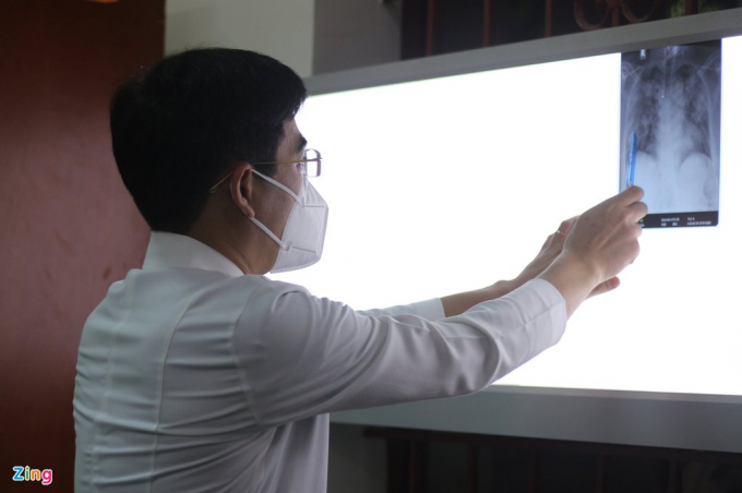 Bác sĩ Nguyễn Hải Công kiểm tra X-quang phổi của bệnh nhân hậu Covid-19. Ảnh: Bích Huệ.