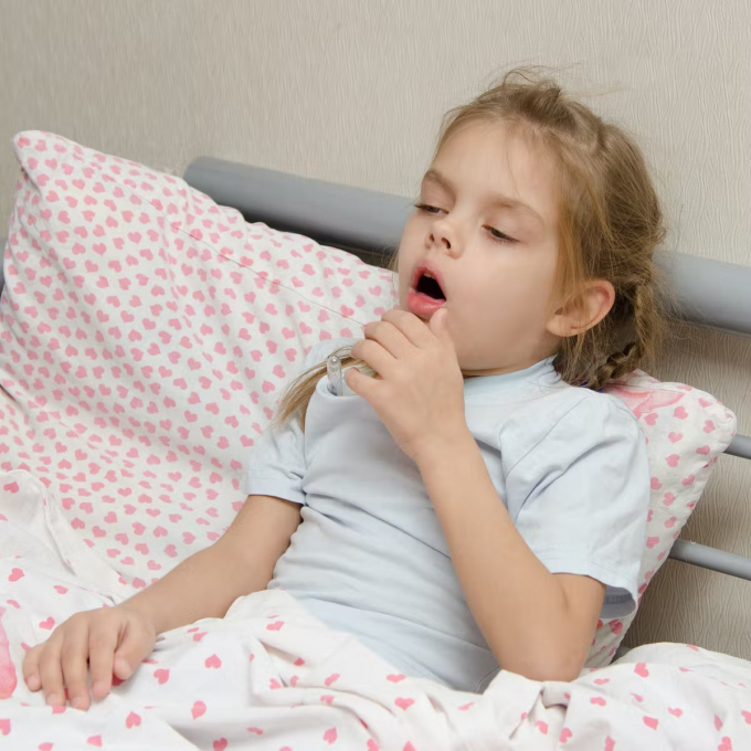 Nhiễm Omicron có thể gây bệnh viêm thanh khí phế quản cấp ở trẻ MINH HỌA: SHUTTERSTOCK