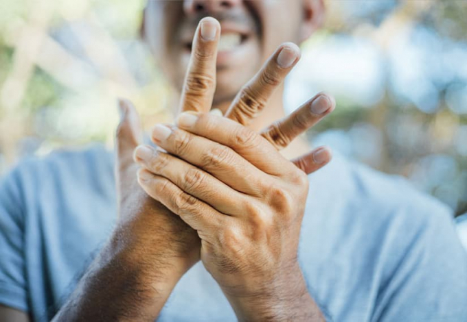 Nghiên cứu mới từ Mỹ cho thấy cảm giác tê bì, ngứa ran tay chân hậu Covid-19 có thể do dây thần kinh ngoại biên bị ảnh hưởng. Ảnh: Cleveland Clinic.