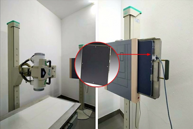 Tên trộm gửi trả lại tấm nhận ảnh X-Quang cho các trung tâm y tế.
