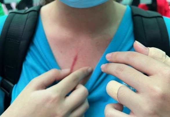 Hình ảnh dấu vết xô xát, cắt từ livestream của một phụ huynh tố con bị đánh tại Trường Quốc tế TPHCM - Học viện Mỹ đang lan truyền trên mạng xã hội những ngày gần đây - Ảnh chụp màn hình