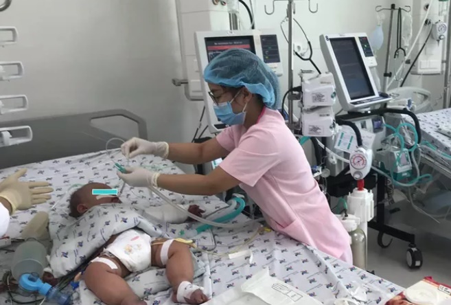 COVID-19 có khả năng gây ảnh hưởng tới độ nặng của sốt xuất huyết