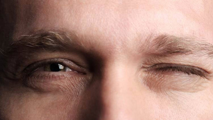 Hầu hết các cơn co giật ở mắt đều tự khỏi SHUTTERSTOCK