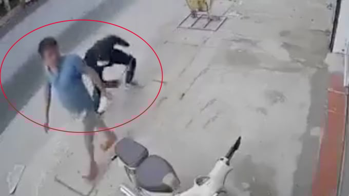 Người đàn ông đang đi bộ thì bị “sát thủ áo đen” tiếp cận, chém đứt lìa chân phải CHỤP MÀN HÌNH