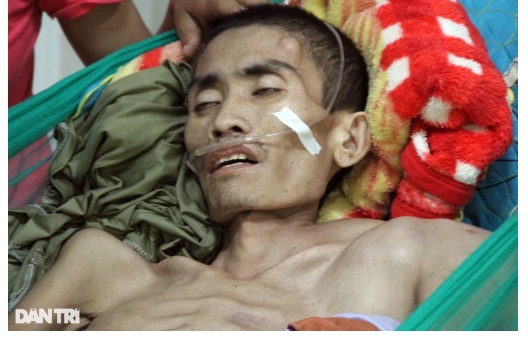 Sau 9 tháng chống chọi với căn bệnh ung thư di căn, thân thể Chí Anh chỉ còn da bọc xương.