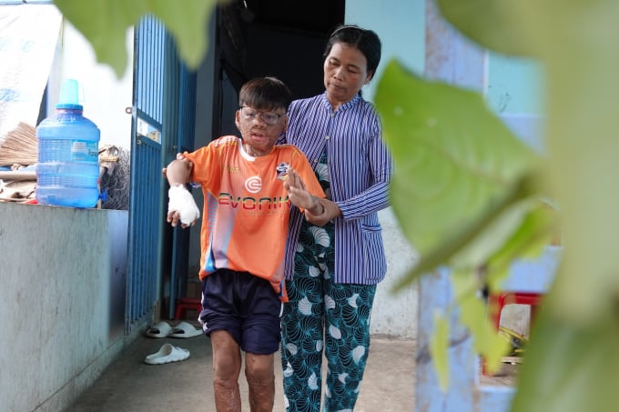 Mỗi ngày, bà Sà Ra tập cho Chính đi đứng DUY TÂN