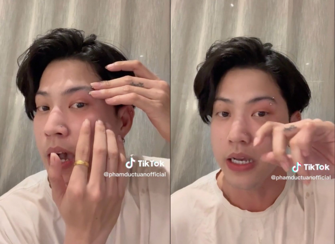 Nờ Ô Nô cho biết anh bị bầm mắt sau sự cố ở phố đi bộ Nguyễn Huệ CHỤP MÀN HÌNH