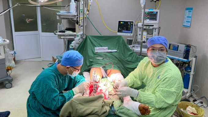 Ca phẫu thuật nối cẳng chân đứt lìa cho bệnh nhân (ảnh: BS)