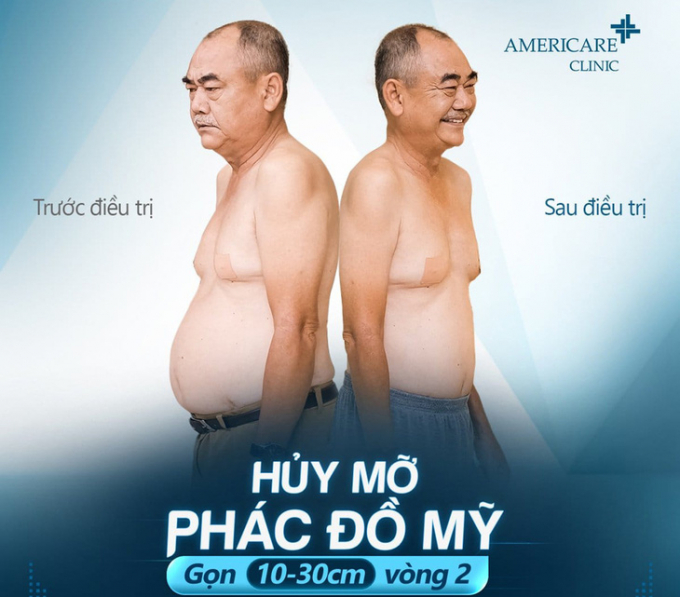 Hình ảnh NSND Việt Anh trong đoạn clip giảm béo tại Americare Clinic