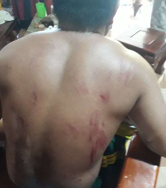 Người đàn ông bị chấn thương do voi tấn công