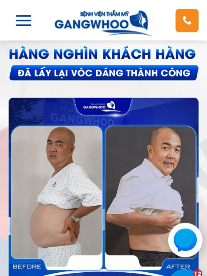 Nghệ sĩ Quốc Thuận cũng quảng cáo màn thoát béo thành công nhờ công nghệ hút mỡ Lipo Untrasound.