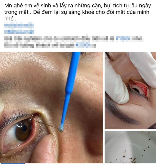 Quảng cáo dịch vụ bắt sâu mắt trên mạng xã hội ẢNH CHỤP MÀN HÌNH FACEBOOK