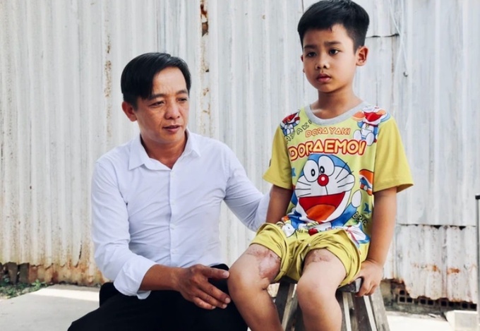 Chủ tịch UBND xã Phong Thạnh hi vọng sự chung tay của mọi người sẽ giúp Quân tiếp tục được chữa trị