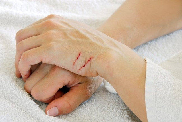 Tự hủy hoại bản thân là họ để giải tỏa những cảm xúc đau khổ xảy ra bằng cách cố ý gây hại cho bản thân về mặt thể chất. Ảnh minh họaTự hủy hoại bản thân là họ để giải tỏa những cảm xúc đau khổ xảy ra bằng cách cố ý gây hại cho bản thân về mặt thể chất. Ảnh minh họa.