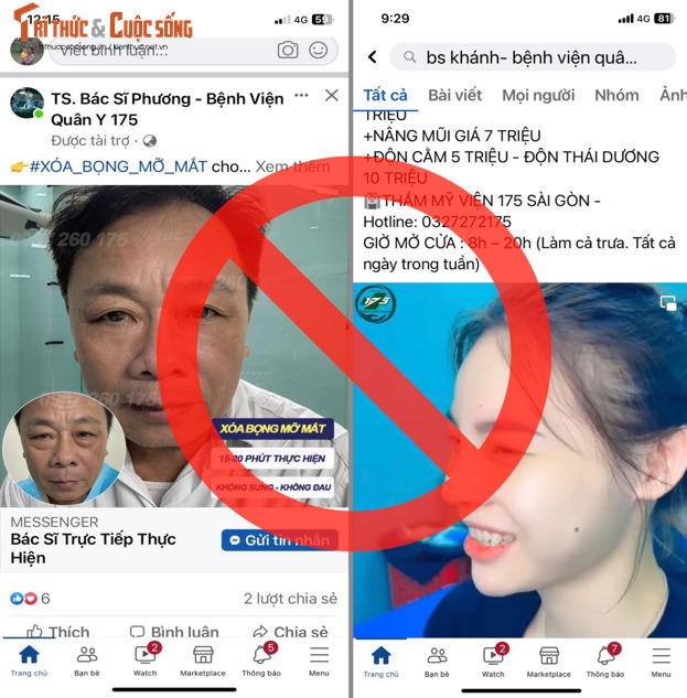 Nhiều bác sĩ Bệnh viện 175 bị các trang fanpage giả mạo tên tuổi để thu hút khách tới làm thẩm mỹ.
