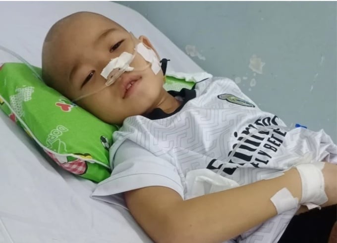 Quân tiều tuỵ vì phải truyền hoá chất. (Ảnh: NVCC)