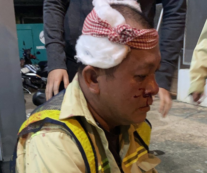 Ca trưởng Lê Ngọc Chánh bị đánh bị thương. Ảnh: CTV