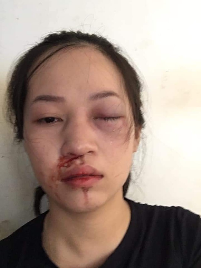 Hình ảnh chị Mai tố CSGT huyện Chiêm Hóa dùng gậy đập vào mặt khiến chị này chảy máu mũi, miệng và mắt bị sưng đỏ (Ảnh cắt từ clip).