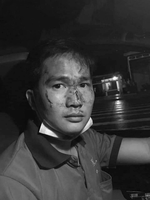 Anh T. bị đánh gây thương tích.