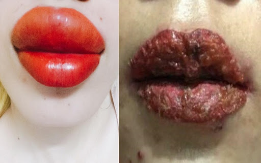 Cặp môi của cô gái đã không còn cứu vãn được nữa