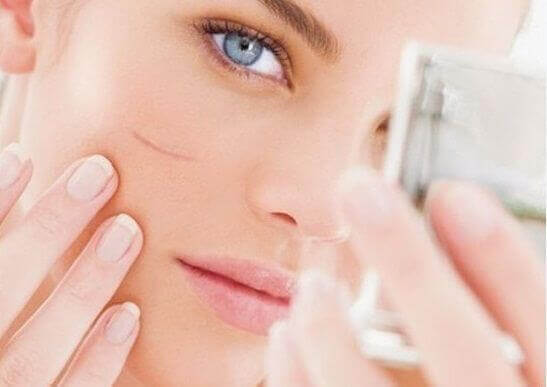 Tăng khả năng liền sẹo