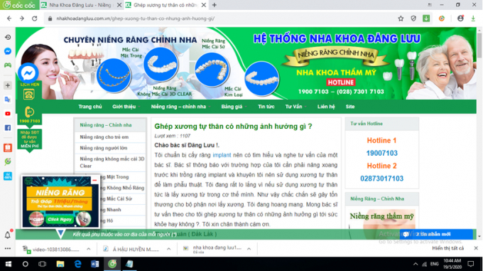 Nha khoa Đăng Lưu quảng cáo dịch vụ không được cấp phép trên https://nhakhoadangluu.com.vn/. Ảnh chụp màn hình
