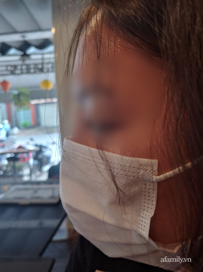 Theo bác sĩ, cô gái 20 tuổi cần ít nhất 6 tháng để mong phục hồi mũi biến chứng.