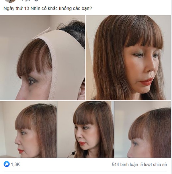 co-dau-thu-sao-nhap-vien-trong-dem-sau-13-ngay-tham-my-chong-tre-livestream-tiet-lo-nguyen-nhan-untitled-1-1594270538-452-width600height607