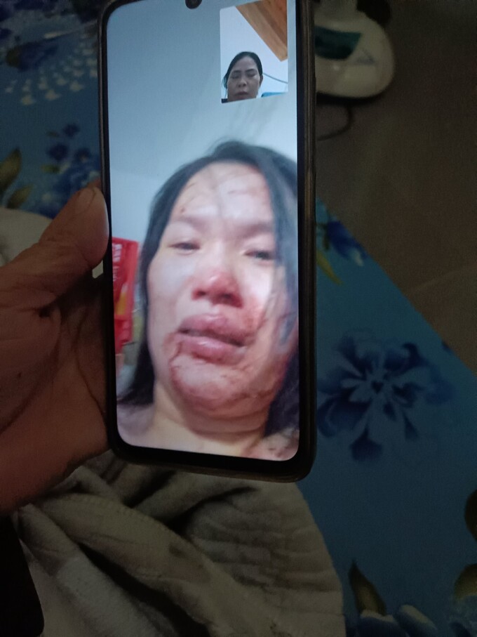 Đòi tiền hụi LTA thẳng tay đánh đập người đầu gối tay ấp hơn 10 năm