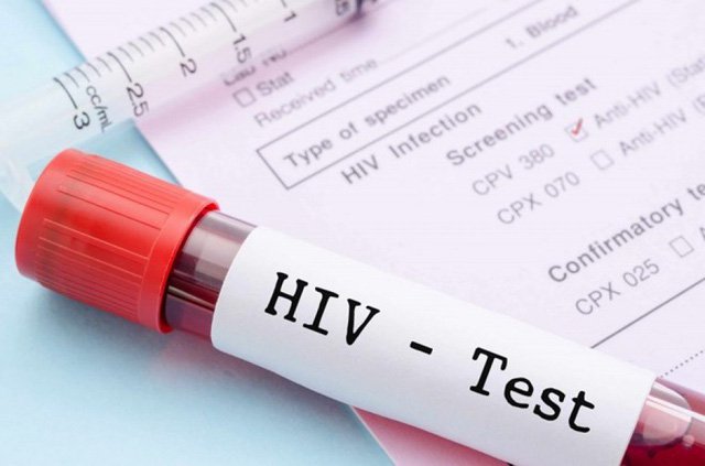 Virus HIV làm suy giảm hệ thống miễn dịch và hiện nay chưa có thuốc chữa khỏi hoàn toàn (ảnh minh họa)