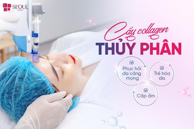 Cấy Collagen thủy phân là dịch vụ chăm sóc da cao cấp và nổi bật nhất tại Seoul Center  