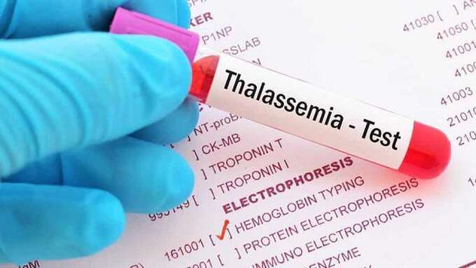 Hưởng ứng Ngày Thalassemia Thế giới năm 2024 (ảnh minh họa)