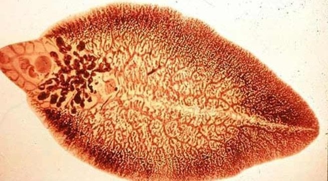 Bệnh sán lá gan nhỏ - Clonorchiasis