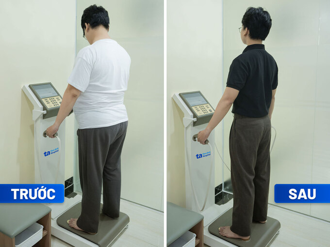 Khách hàng được đo chỉ số cơ thể (InBody) trước và sau điều trị giảm cân để theo dõi sự tình trạng mỡ nội tạng, tỷ lệ mỡ và khối cơ đang diễn tiến thế nào suốt liệu trình giảm cân (Ảnh: BVĐK Tâm Anh)