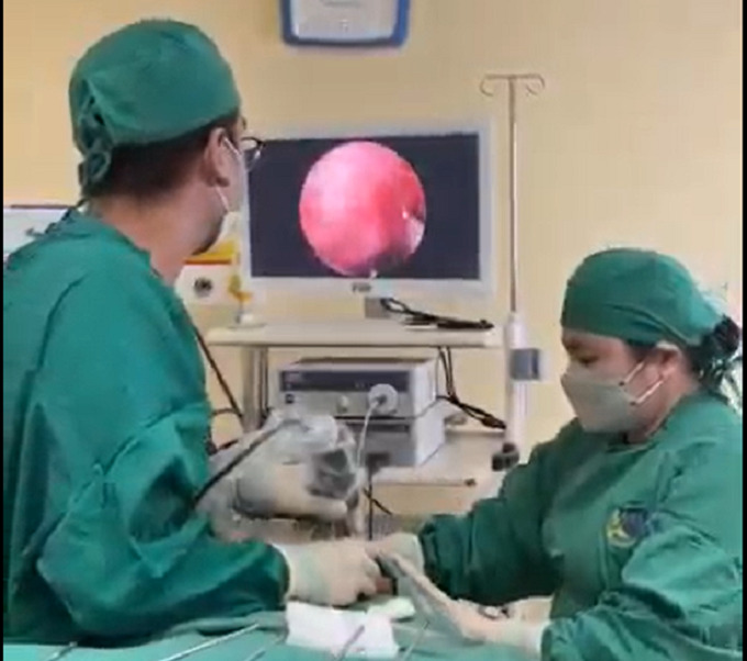 Ekip phẫu thuật nội soi lấy dị vật cho bệnh nhi