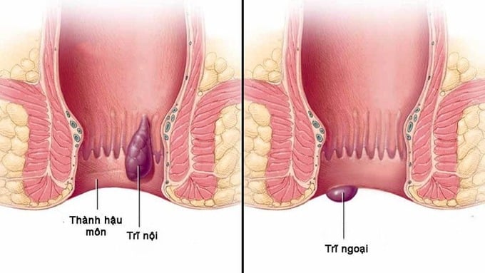 Ảnh: Bệnh viện Bạch Mai