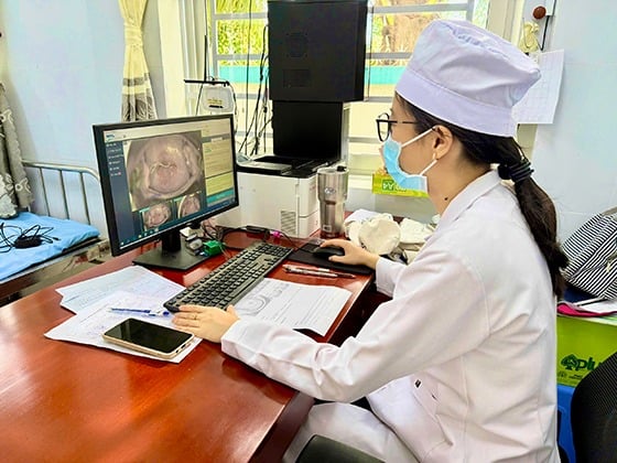 Hình ảnh được phân tích bằng trí tuệ nhân tạo AI, có kết quả ngay sau khi khám, hỗ trợ bác sĩ trong việc sàng lọc và phát hiện sớm ung thư cổ tử cung