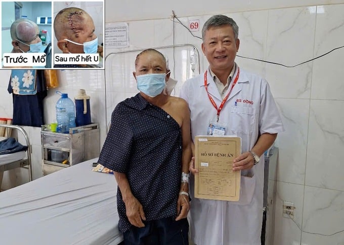 Bệnh viện Đa khoa vùng Tây Nguyên phẫu thuật thành công khối u khổng lồ cho bệnh nhân