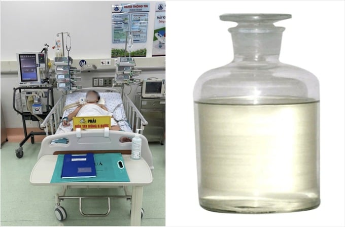 Bé trai 13 tuổi khoẻ mạnh đột ngột hôn mê, suy hô hấp nặng do hít phải khí độc hại styrene dùng để hàn nhựa (Ảnh: SYT)